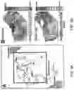 Fig. 06 - Method and device for atrial cardioversion therapy
