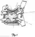 Fig. 10 - Method and device for atrial cardioversion therapy