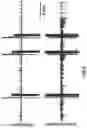 Fig. 25 - Method and device for atrial cardioversion therapy