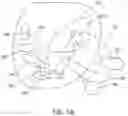 Fig. 08 - Radiosurgical neuromodulation close to critical structures