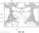 Fig. 09 - Radiosurgical neuromodulation close to critical structures