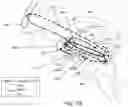 Fig. 12 - Radiosurgical neuromodulation close to critical structures