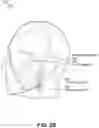 Fig. 04 - Noninvasive tissue tightening system