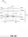 Fig. 06 - Noninvasive tissue tightening system