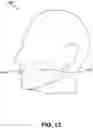 Fig. 25 - Noninvasive tissue tightening system