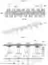 Fig. 05 - High intensity focused ultrasonic surgical device with eccentric driving cam