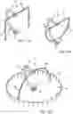 Fig. 15 - Climbing-wall and pendulum-fall, swing apparatus and method