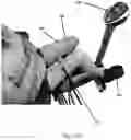 Fig. 17 - Interactive cycling system and method of using muscle signals to control cycling pattern stimulation intensity
