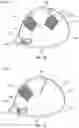 Fig. 08 - High density outer layer of a golf club head