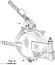 Fig. 03 - Vessel closure device with fail safe failure detection means