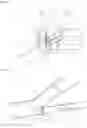 Fig. 04 - Microchip and microparticle fractionating device