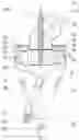 Fig. 02 - Separator, separator mill and method for separating a gas-solids mixture