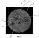 Fig. 07 - Fibrous structures comprising regions having different solid additive levels