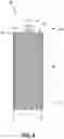 Fig. 07 - Drill Bit Having a Spiral-Tube-Shaped Drill Shaft and Method for Producing a Spiral-Tube-Shaped Drill Shaft for a Drill Bit