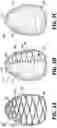 Fig. 04 - System and method for additive manufacturing of skin-formulation applicators