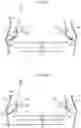 Fig. 08 - Sensor protector and vehicle equipped therewith