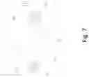Fig. 08 - Disk Intelligent Rechargeable Locking Device for Wheels Based on Cloud Wireless Control