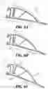 Fig. 07 - Remote optical wind detection and aerodynamic control system for ground vehicle