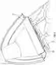 Fig. 07 - Dinghy made from separate floating elements