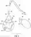 Fig. 03 - Buoy assembly
