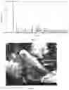 Fig. 09 - PHARMACEUTICAL CO-CRYSTAL COMPOSITION AND USE THEREOF