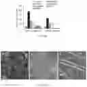 Fig. 09 - COMPOSITIONS AND METHODS OF DETERMINING A LEVEL OF INFECTION IN A SUBJECT