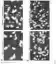 Fig. 10 - Anti-podocalyxin antibodies and methods of using the same