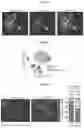 Fig. 22 - METHODS OF TREATING NEURODEGENERATIVE DISEASES BY INDUCING DISEASE-ASSOCIATED MICROGLIA (DAM) CELLS