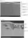 Fig. 06 - Composition, Composite Membrane, and Membrane Electrode Assembly