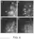 Fig. 04 - Zwitterionic nanoparticles