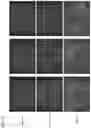 Fig. 06 - METHOD FOR PRODUCING VACCINIA VIRUS EXPRESSING FOREIGN GENE