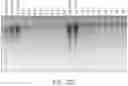Fig. 16 - AUTOMATED METHOD FOR RELEASE OF NUCLEIC ACIDS FROM MICROBIAL SAMPLES