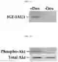 Fig. 03 - Method of treating type I diabetes using an AAV vector encoding uracortin 2