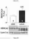 Fig. 16 - Method of treating type I diabetes using an AAV vector encoding uracortin 2