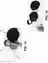 Fig. 02 - Thread tensioner for retractable crochet weave