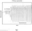 Fig. 07 - MEMS fluid pump with integrated pressure sensor for dysfunction detection