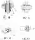 Fig. 13 - Expandable collet bodies with sectional finger-based anti-rotation feature, clips, inserts and systems thereof