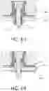 Fig. 17 - Expandable collet bodies with sectional finger-based anti-rotation feature, clips, inserts and systems thereof