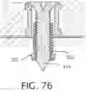 Fig. 20 - Expandable collet bodies with sectional finger-based anti-rotation feature, clips, inserts and systems thereof