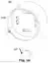 Fig. 07 - VARIABLE TORQUE DIFFERENTIAL
