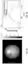 Fig. 09 - Single-shot method for edge illumination X-ray phase-contrast tomography
