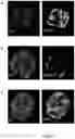 Fig. 08 - Marker for Neural Stem Cells