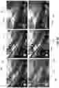 Fig. 09 - Methods and systems for exploiting per-pixel motion conflicts to extract primary and secondary motions in augmented reality systems