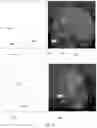 Fig. 05 - 3D object scanning method using structured light