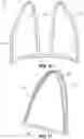 Fig. 09 - Wearable partial task surgical simulator