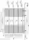 Fig. 03 - Sensing operations in memory by comparing inputs in a sense amplifier