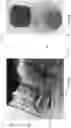 Fig. 08 - Sulfide and oxy-sulfide glass and glass-ceramic solid state electrolytes for electrochemical cells