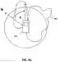 Fig. 13 - Methods and apparatus for client-based dynamic control of connections to co-existing radio access networks