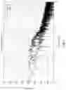 Fig. 06 - MEMS microphone