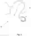 Fig. 02 - Body temperature hearing aid